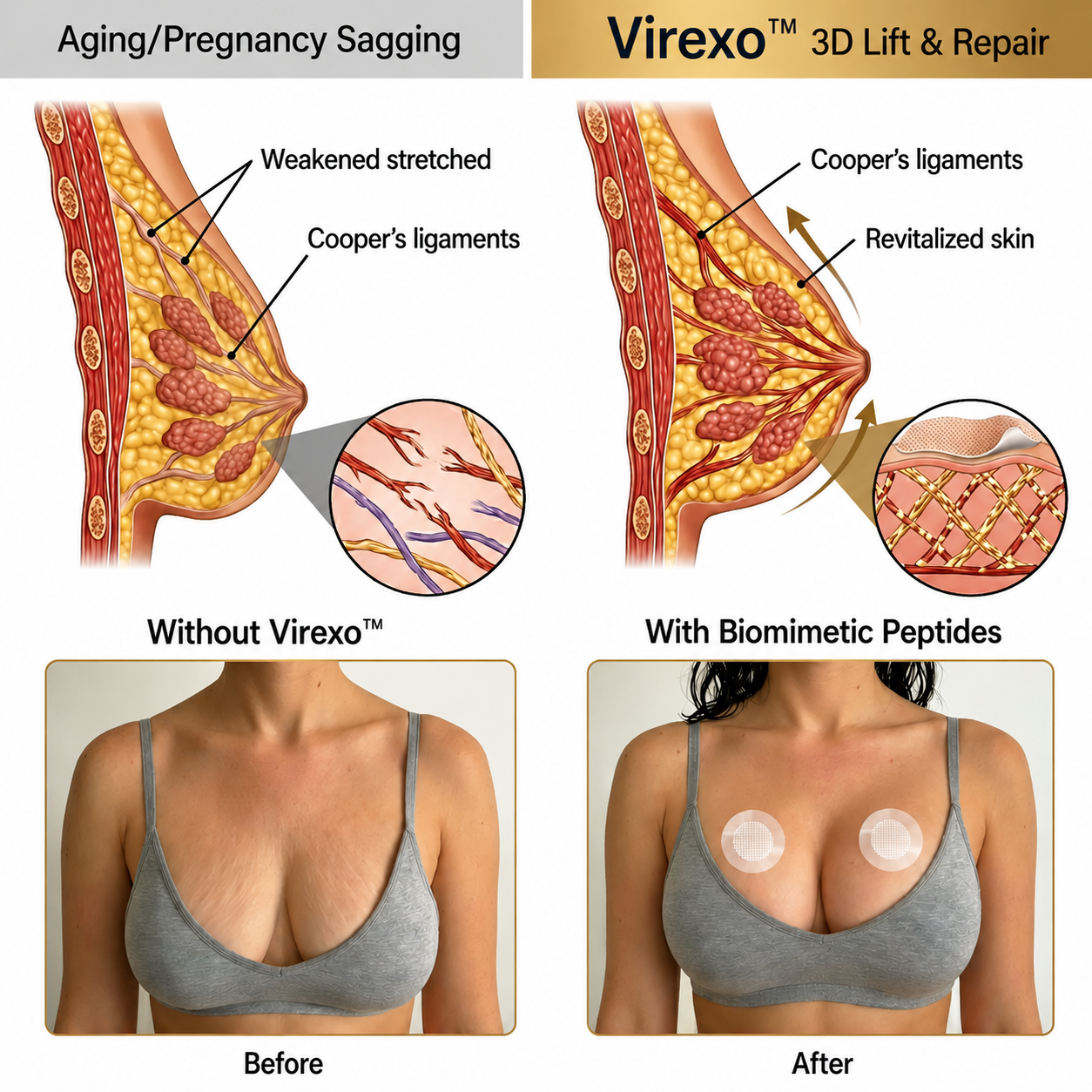 💥Virexo™ 💥Targeted Breast Enhancement Advanced Nano Microneedle Patch💥💥💥