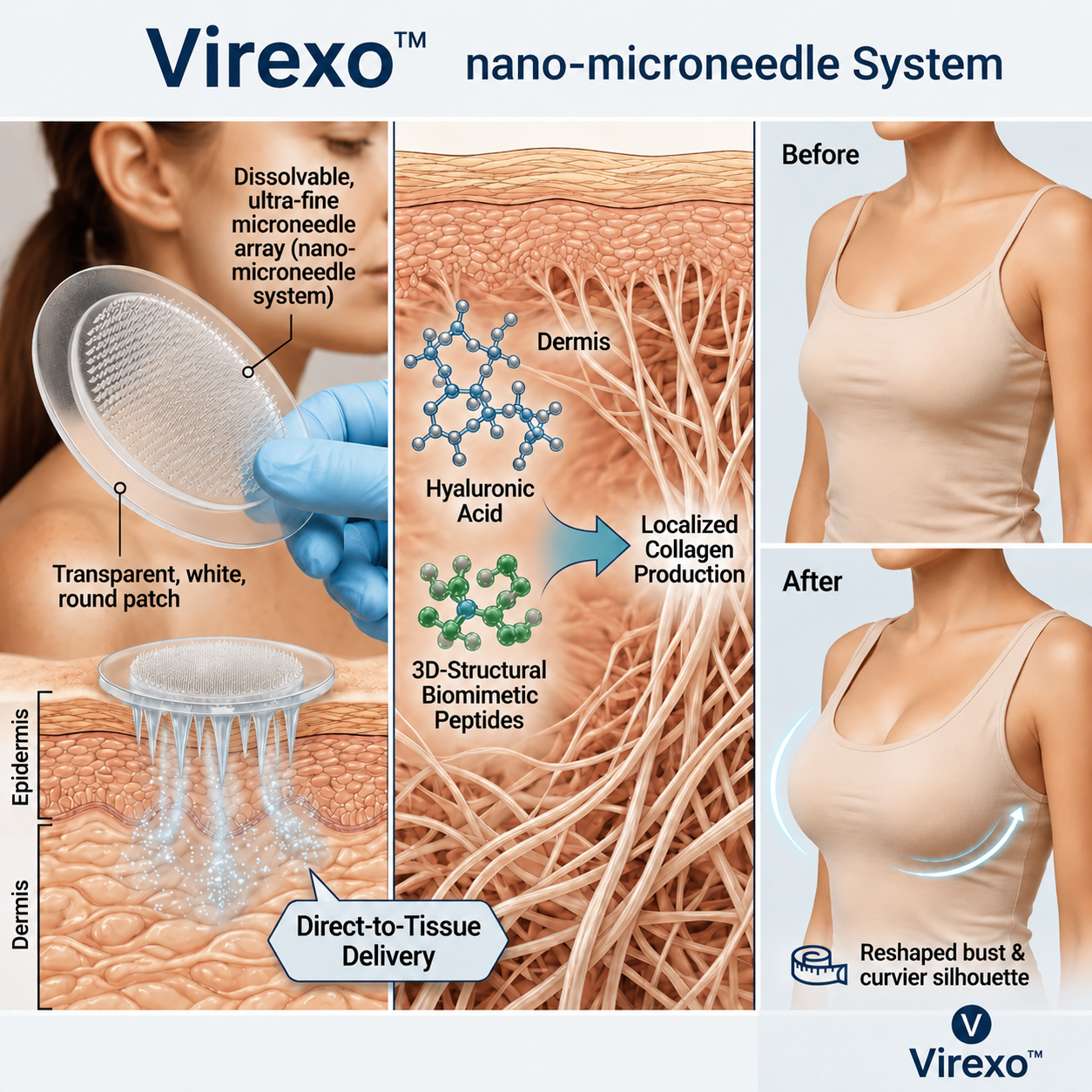 💥Virexo™ 💥Targeted Breast Enhancement Advanced Nano Microneedle Patch💥💥💥